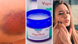 Vicks VapoRub Kremi ve Farklı Kullanım Şekilleri