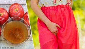 Vajinal Kaşıntı ve Yanma İçin Tedaviler