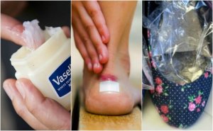 Ayakkabı Vurmasını Önlemek için 7 Yöntem