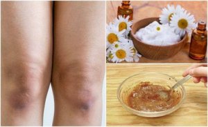 Bu 5 Doğal Eksfoliant İle Dizlerinizin Cilt Rengini Açın