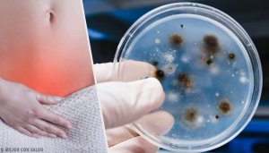 Vajinal Enfeksiyonların Çeşitleri Ve Sebeplerini Öğrenin