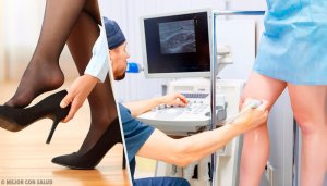 Bu 3 Doğal Çare ile Varisli Damarları Unutun