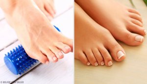 Ayak Bünyonları Ameliyatsız Ortadan Kaldırabilir Mi?