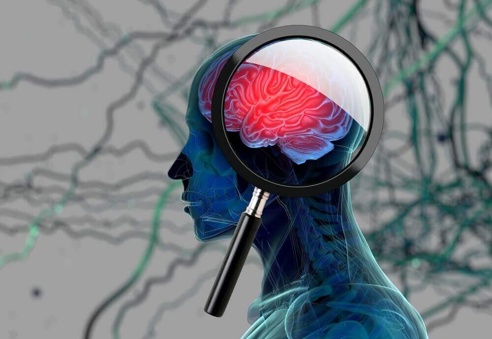Alzheimer’ın belirtileri için beyne büyüteçle bakmak