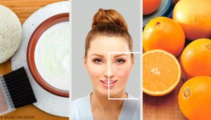 Ciltteki Lekelerden Kurtulmanın Olağanüstü Doğal Yolları