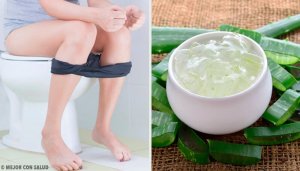 Hemoroid İçin Doğal Tedavi Yöntemleri