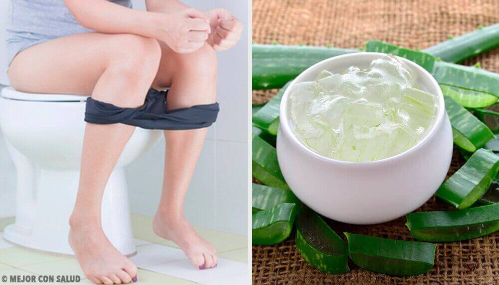 Hemoroid İçin Doğal Tedavi Yöntemleri