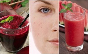 Akneler için Bu 5 Smoothie Tarifini Deneyin!