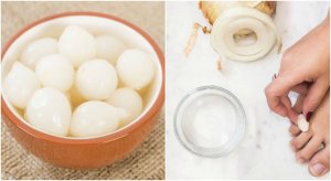 Ayaklarınızdaki Nasır İçin Doğal Çözümler