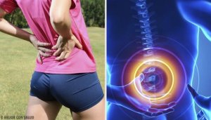 Bel Ağrısı: Belinizi Güçlendirmek İçin Egzersiz Yapın