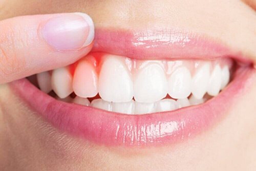 Diş Eti Enfeksiyonları İçin 5 Etkili Tedavi Yöntemi