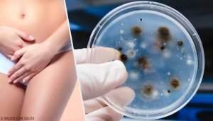 Vajinal EnfeksiyonlarınTürleri ve Sebepleri