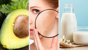 Kuru Ciltleri Nemlendirmek için En İyi 10 Ev Yapımı Ürün