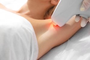 Lazer Epilasyon Hakkındaki Mitler Ve Gerçekler