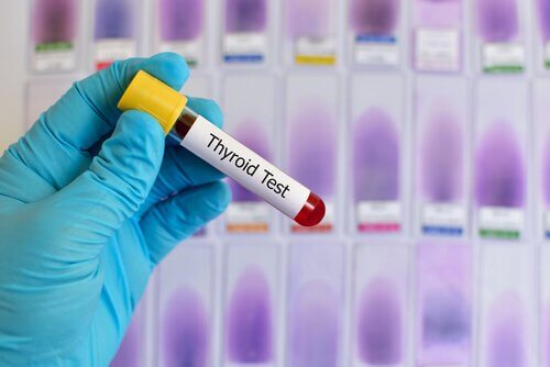 tiroid testi
