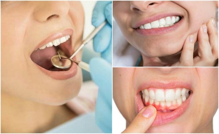 Bir Diş Enfeksiyonuna İşaret Eden 7 Semptom