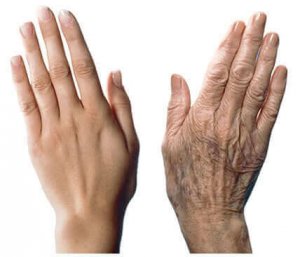 Ellerinizin Yaşlanmasını Önlemek için 7 Bakım Önerisi