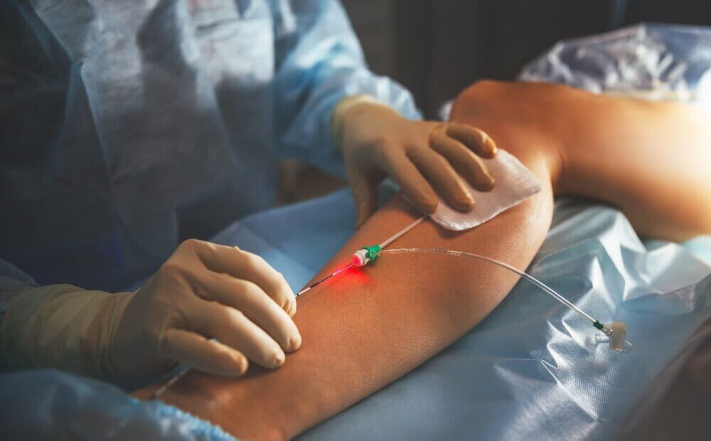 doktor skleroterapi yapıyor