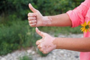 Otoimmün Hastalıklar: Hangi Yiyecekleri Yemeli, Hangilerinden Kaçınmalı