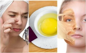 Cildinizi Güzelleştirmek için Bu 5 Yumurta Maskesini Deneyin