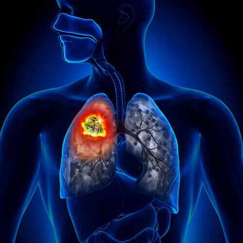 akciğer hastalık grafik görsel