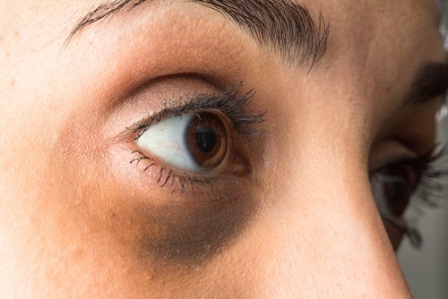 Esansiyel Yağlar ile Gözlerin Altındaki Koyu Renk Nasıl Giderilir
