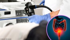 Kolon Kanseri Tedavisi Hakkında Bilmeniz Gereken Her Şey