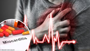 Miyokardit nedir?