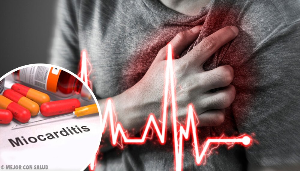 Miyokardit nedir?