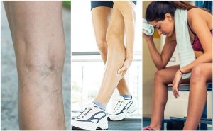 Kaslarınıza Kramp Girmesine Sebep Olabilecek 6 Durum