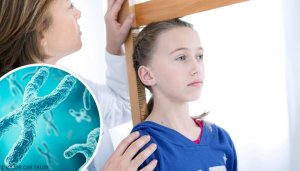 Turner Sendromu Hakkında Bilmeniz Gereken Her Şey