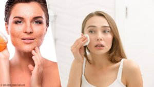 Kuru Cilt Tek Bir Seferde Nasıl Tedavi Edilir?