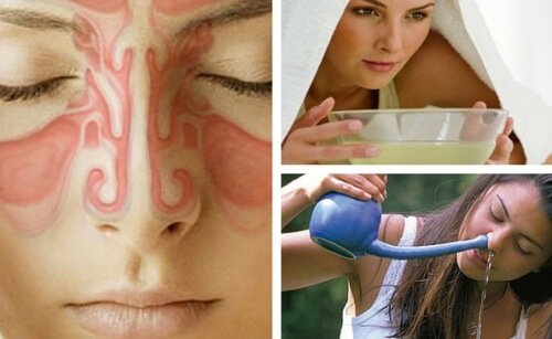 Paranazal sinüs tedavisi uygulayan kadınlar