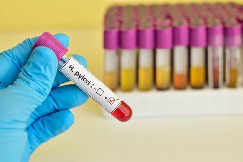 kan testi h pilori