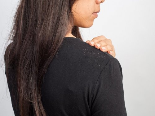 kepek kadın siyah bluz