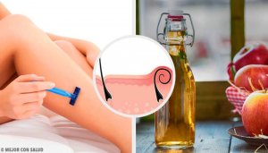 Tıraştan Sonra Tahriş İçin 5 Doğal Çare