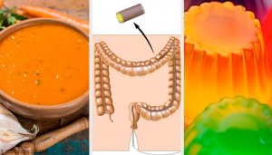 Kolonoskopi Öncesi Beslenme Ve Hazırlık