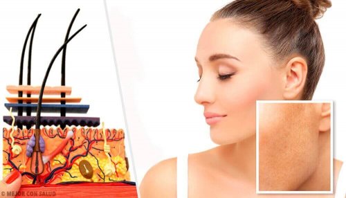 Cilt Lekeleri Ve Nedenleri