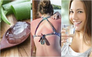 Güneş Yanıklarını Tedavi Etmenin 9 Yolu