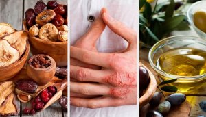 Egzama Nedir: Nedenleri, Belirtileri, Tanısı Ve Tedavisi