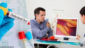 İdeal Kolesterol Seviyesi İle İlgili Endişeler