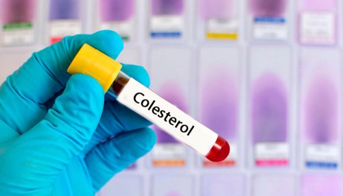 Bu Altı Bitkisel Reçeteyle Yüksek Kolesterolü Azaltın