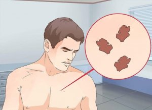 Anormal Cilt Lekeleri İçin Doğru Tedavi Nedir?