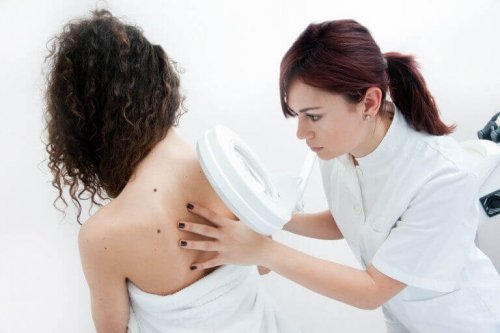 hastasını teşhis eden doktor ve anormal cilt lekeleri