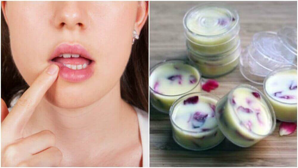 Nemlendirici Dudak Kremi İle Dudaklarınızı Koruyun