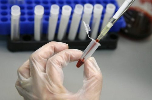 Kök Hücre Nakli HIV'i Ortadan Kaldırabilir