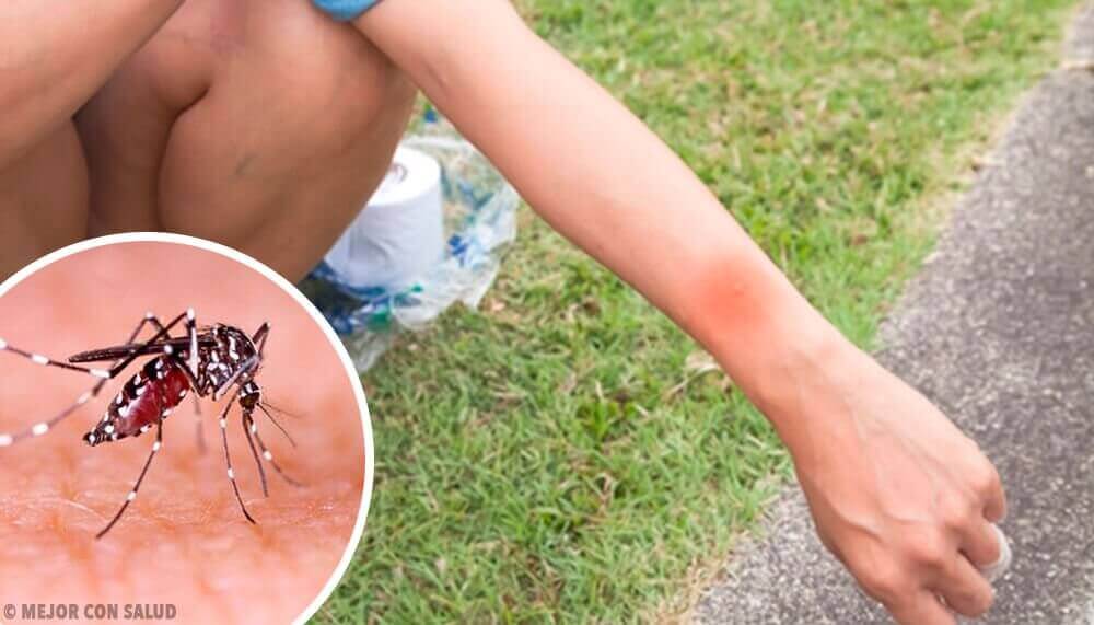 Sivrisinek Isırığı ve Sonuçları Nelerdir?