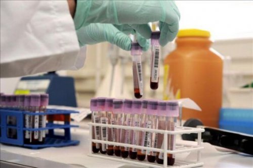 HIV tedavisi