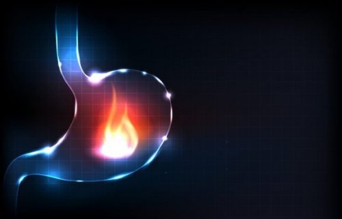 mide ekşimesini iyileştirmek