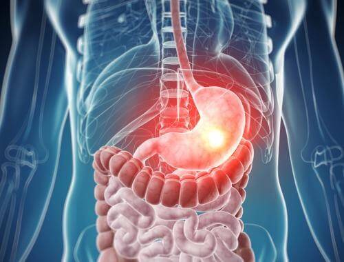 Temel Gıda İntoleransları Nelerdir?